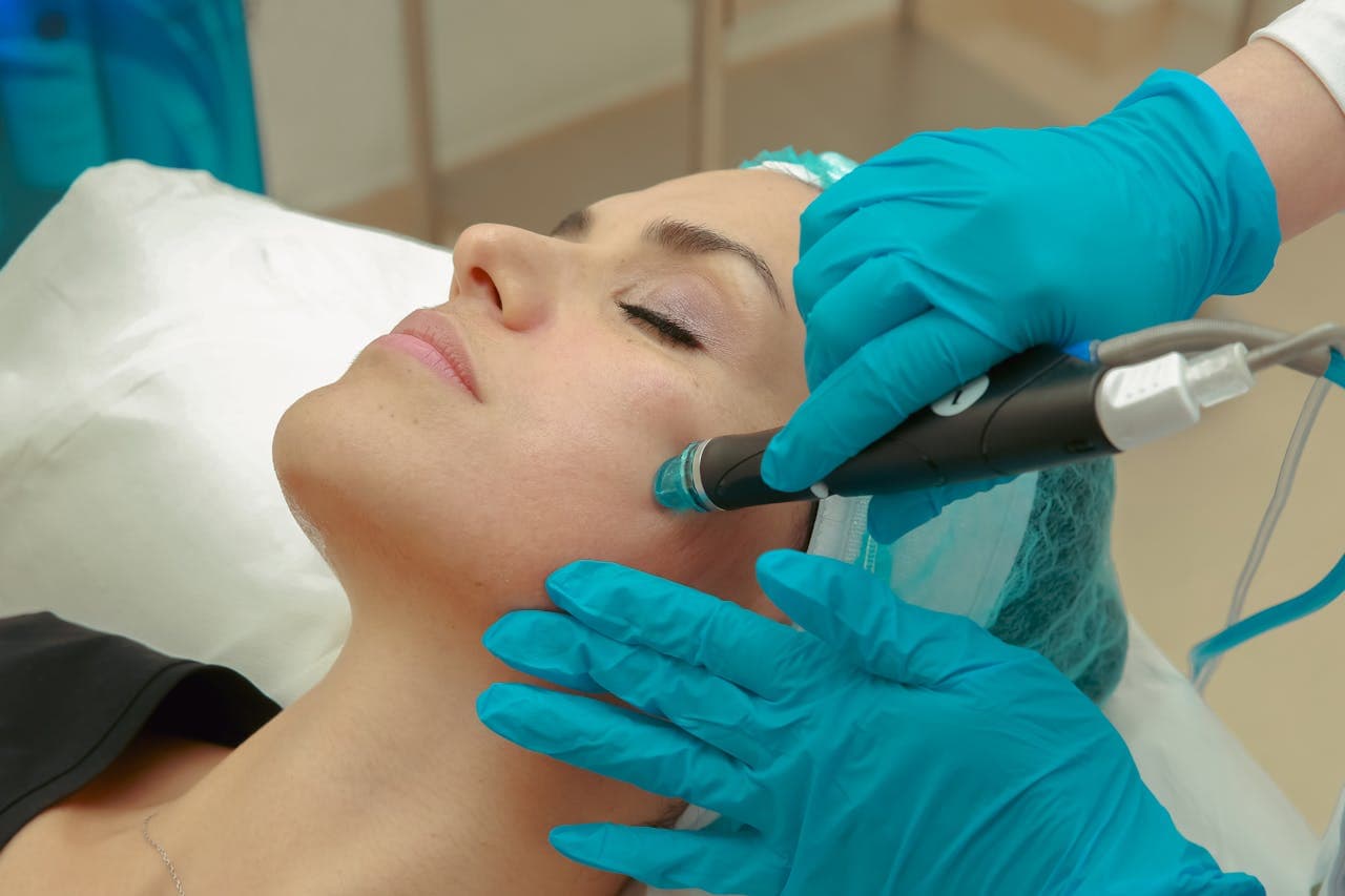 Exosomen mit Microneedling – Die Zukunft der Hautpflege