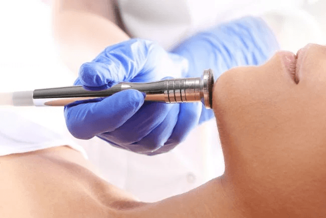 Dermabrasion: Alles, was Du wissen musst