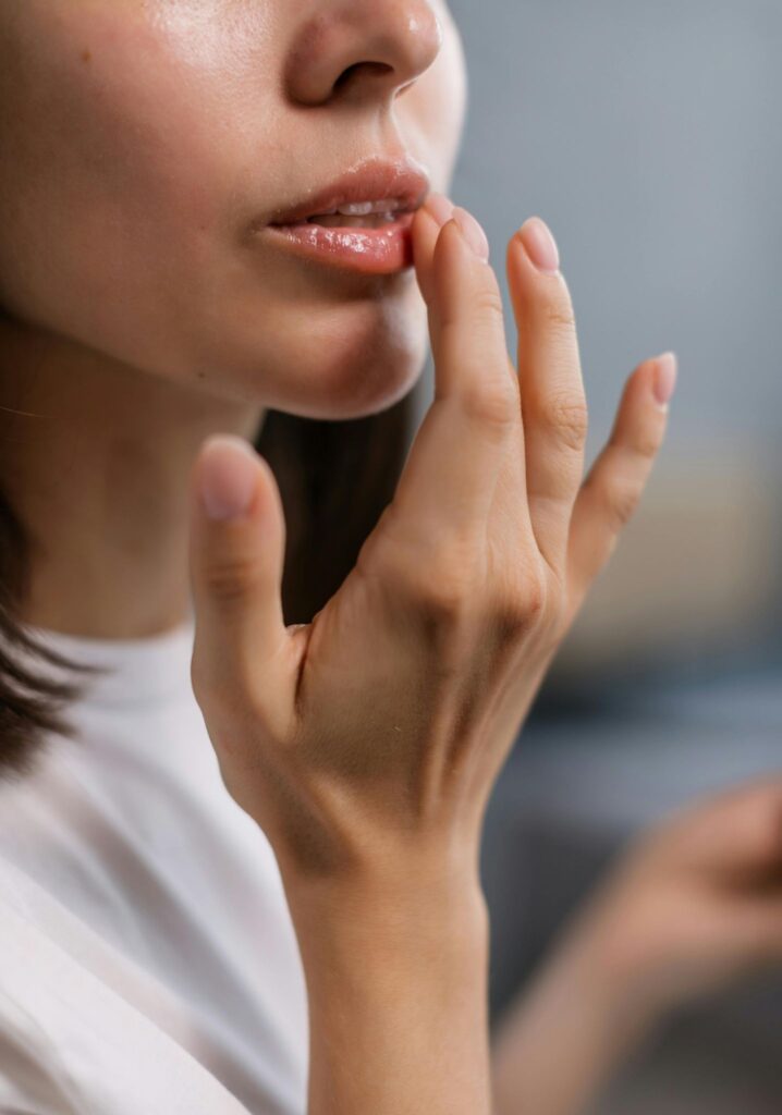 Vorher Nachher Botox Lippen