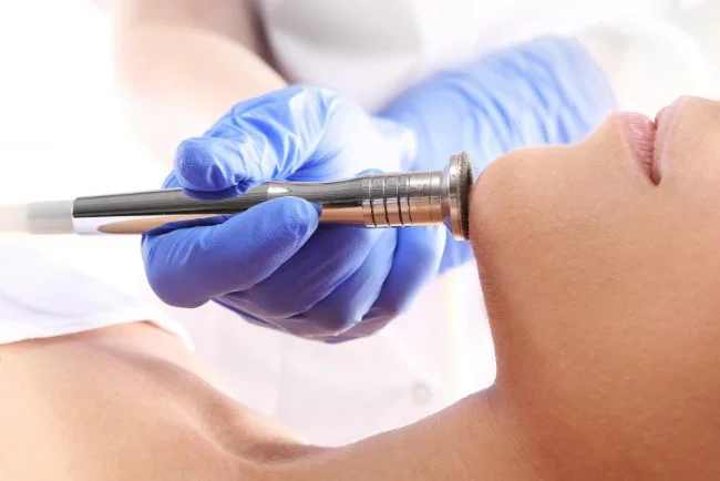 Dermabrasion: Alles, was Du wissen musst