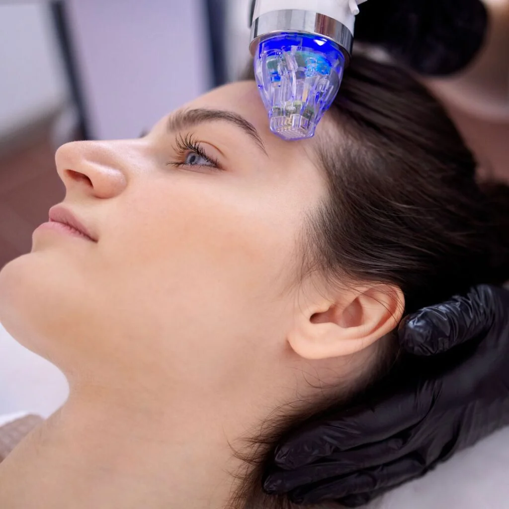 radiofrequenz und microneedling minimal-invasive verfahren